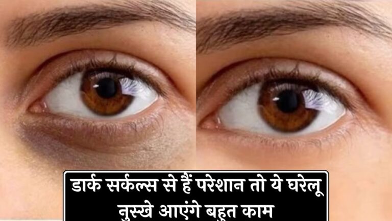 how to remove dark circles in hindi