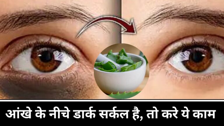 aloe vera for eye dark circles