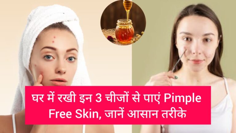 Pimple Free Skin