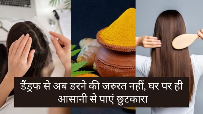 Best dandruff treatment at home hindi