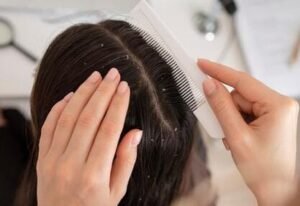 Hair care tips for girl